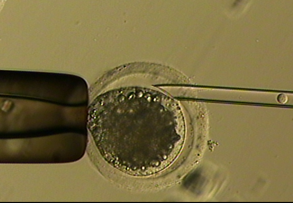 未受精卵の核を体細胞の核と入れ替え