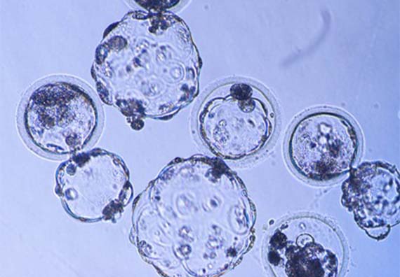 胚盤胞