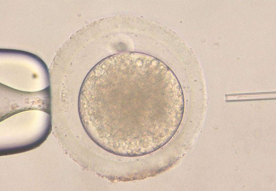 未受精卵の細胞質内に1個の精子を注入